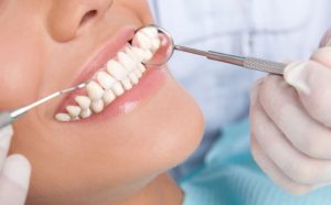 Tot ce trebuie să ştii dacă vrei să îţi faci un implant dentar